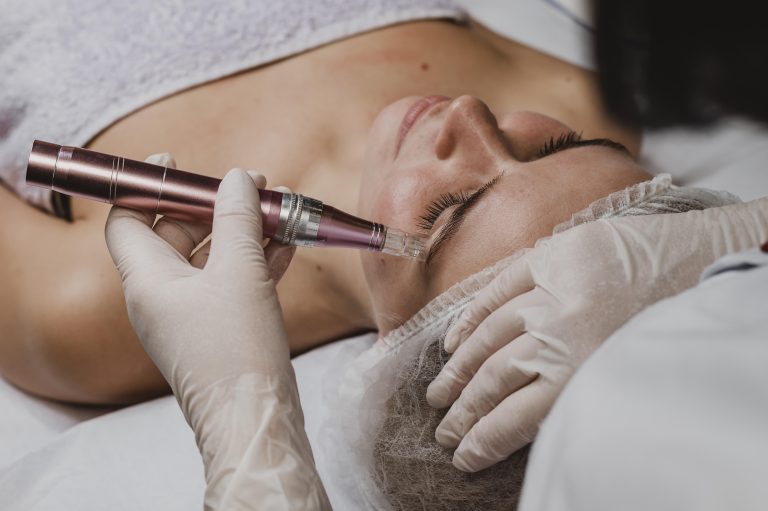 Morpheus8 exosomes skin renewal