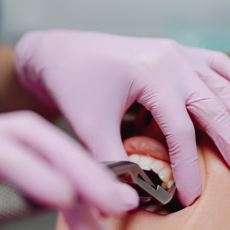 Close-up of dental tools in use during a patient's examination in a dental clinic.